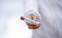 W Rosji przeprowadzono już ponad 86 mln testów na koronawirusa