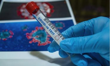 Nieoficjalnie: Moskwa zakupiła holenderskie testy na koronawirusa, które okazały się chińskie i wadliwe