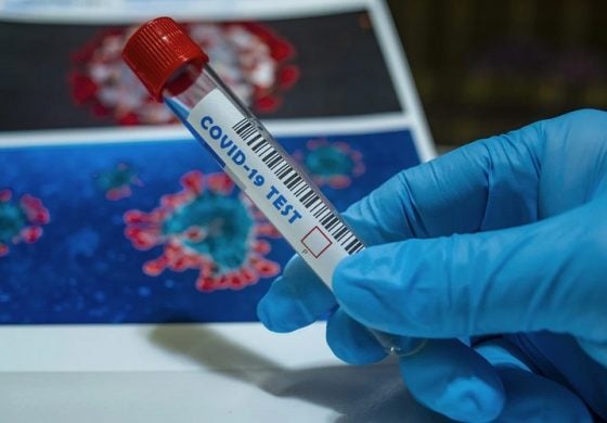 Nieoficjalnie: Moskwa zakupiła holenderskie testy na koronawirusa, które okazały się chińskie i wadliwe