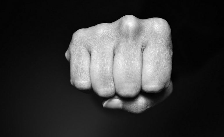 Nowosybirsk: Bili 12-letniego chłopca aż złamali mu kręgosłup. Bo nie chciał zdjąć aparatu na zęby