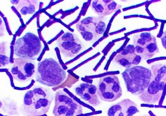 W Dagestanie hospitalizowano pięć osób z podejrzeniem zarażenia wąglikiem