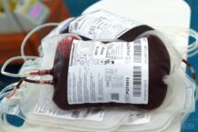 Z powodu pandemii koronawirusa i ograniczenia komunikacji na Ukrainie nasilił się niedobór krwi w stacjach krwiodawstwa Z powodu pandemii koronawirusa i ograniczenia komunikacji na Ukrainie nasilił się niedobór krwi w stacjach krwiodawstwa