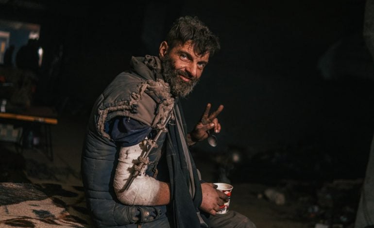 Niech cywilizowany świat zobaczy, w jakich warunkach żyją i działają ranni, okaleczeni obrońcy Mariupola! (FOTO)