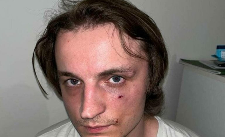 Białoruski muzyk pobity w centrum Warszawy. Rozmawiał po rosyjsku