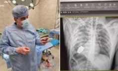 Niesamowita operacja w asyście saperów. Z ciała rannego żołnierza wydobyto pocisk z granatnika