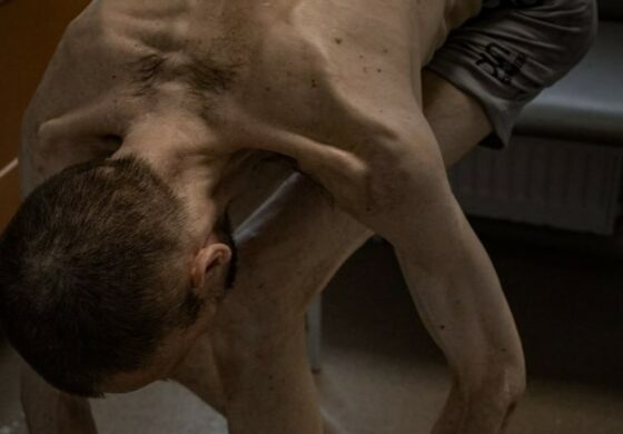 Tak wyglądają ludzie po dwóch latach rosyjskiej niewoli (FOTO)