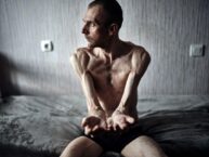Tak się wygląda po powrocie z ruskiej niewoli (FOTO) Tak się wygląda po powrocie z ruskiej niewoli (FOTO)