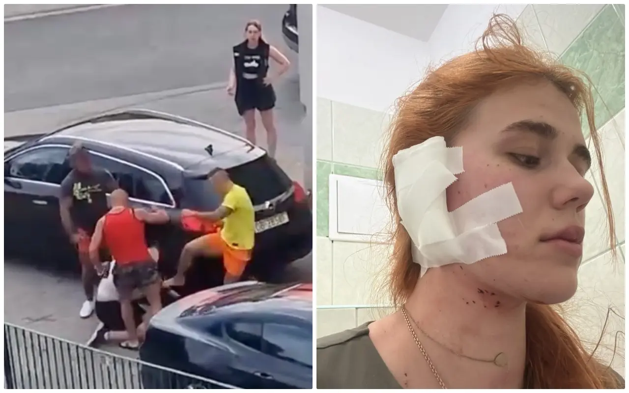 Trzech na jednego! Usłyszeli ukraiński i zaatakowali… (WIDEO 18+)